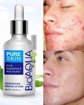 Bioaqua Acne Removal Serum & Solution – Nest Mart